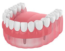 affordable dentures